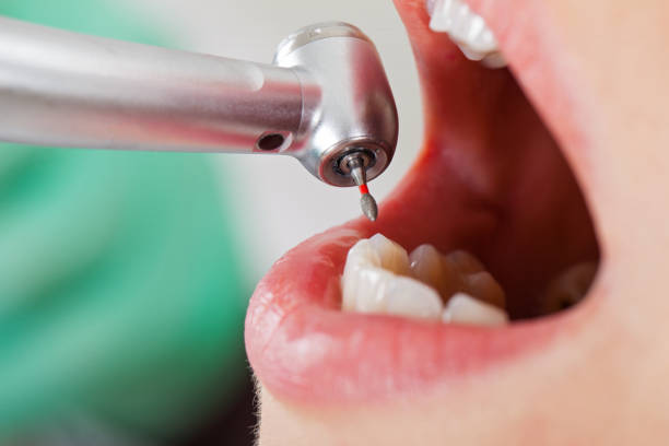 Best Emergency Broken Tooth Repair in Freeland, MI